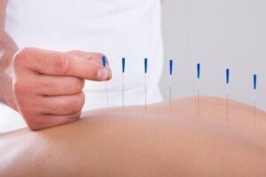 Northeastern Reproductive Medicine launching on-site acupuncture